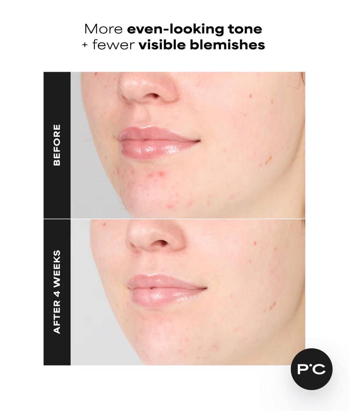 Skin Perfecting 1% BHA Gentle Exfoliating Gel Toner